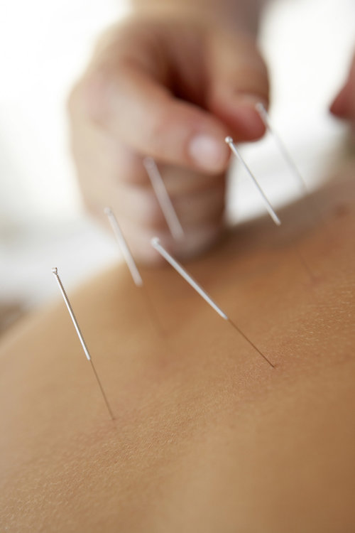 Acupuncture Efficacy : The WHOs Full List of Conditions